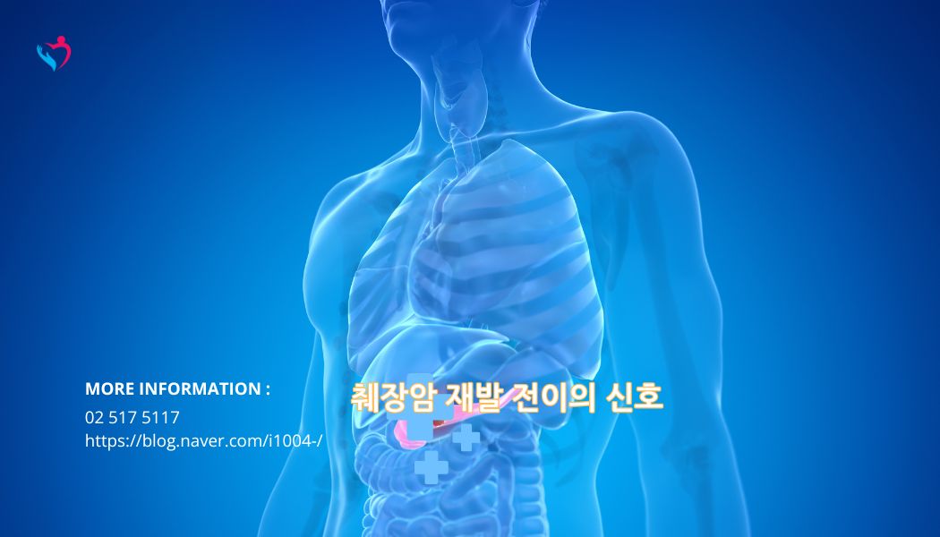 암 재발 전이 신호 중요성