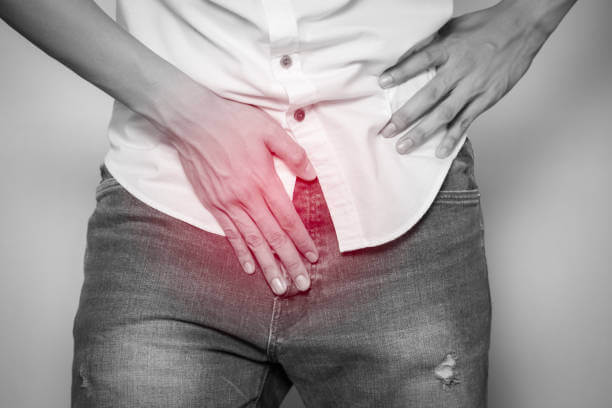 허혈성 대장염 증상과 원인, 치료방법, 예방법