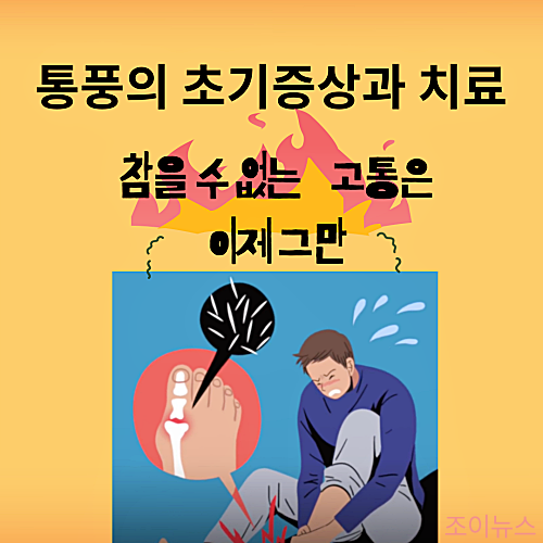 통풍의 증상과 치료, 예방법까지 모두 알아보아요!