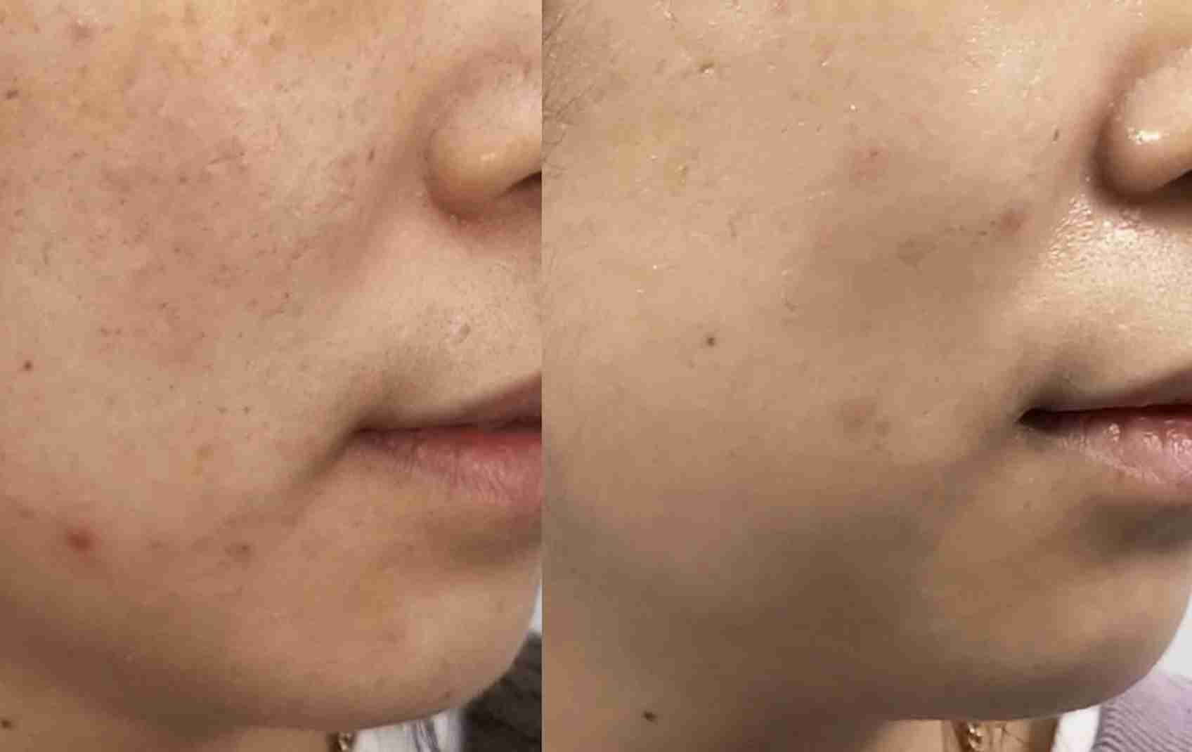 듀얼 토닝