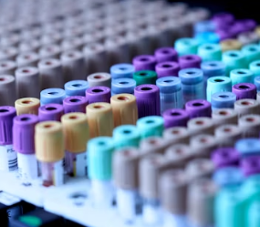 빈혈 증상 원인 치료 방법