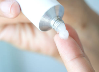 스테로이드 연고