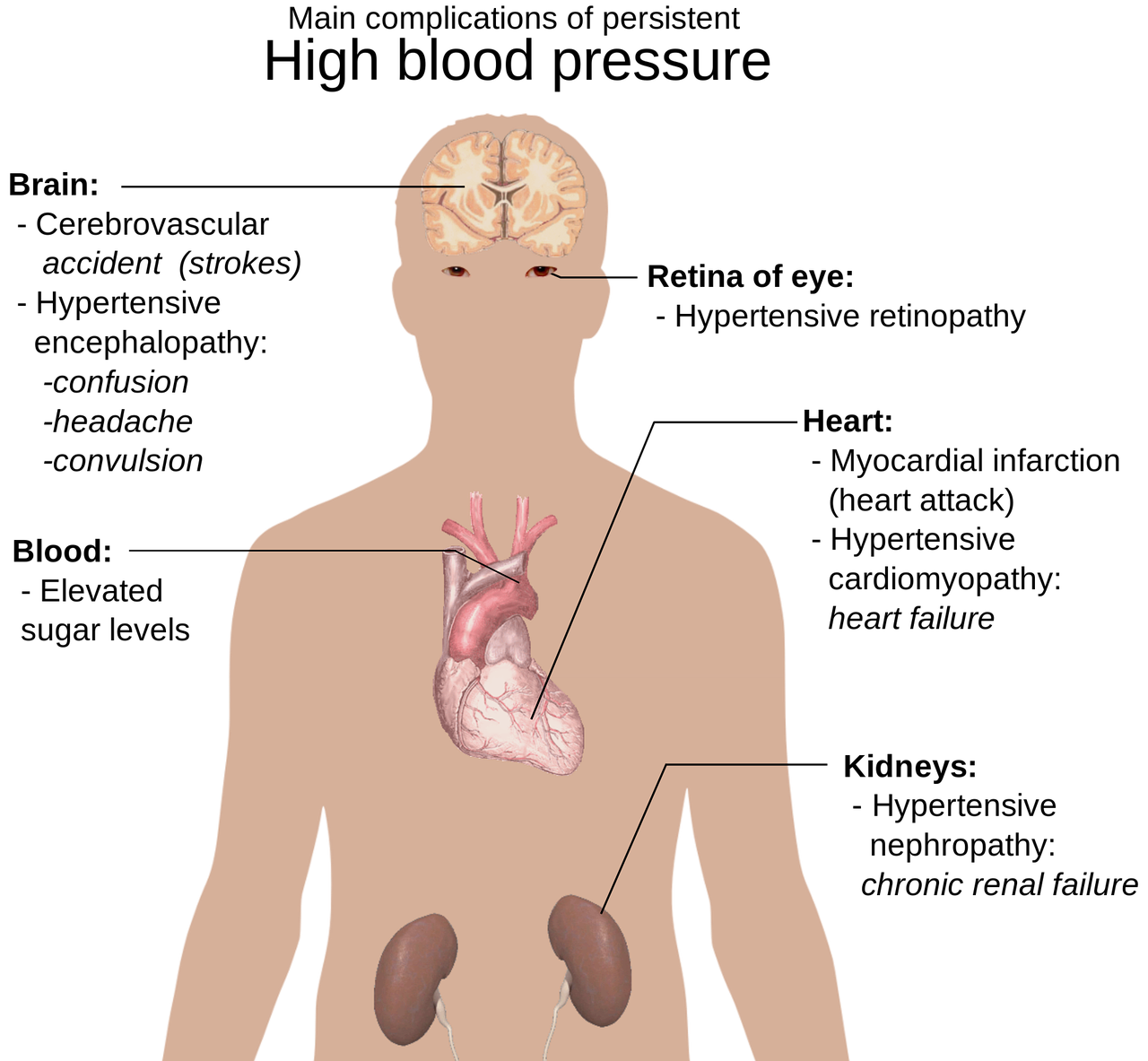 고혈압 관련 사진