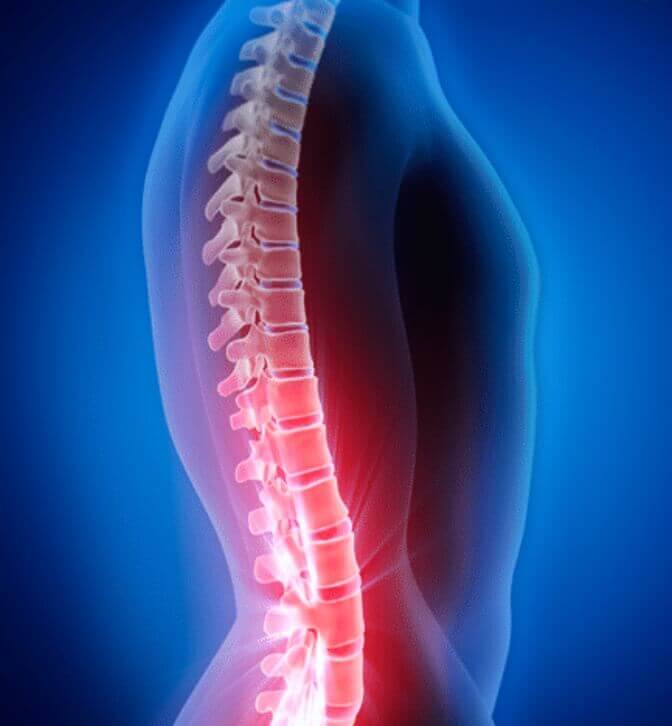 허리통증원인 척추