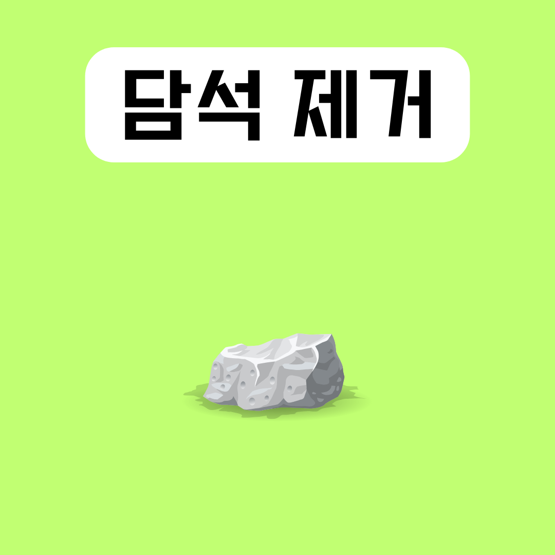 담석-제거