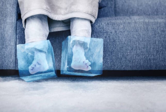 동상증상-동상원인