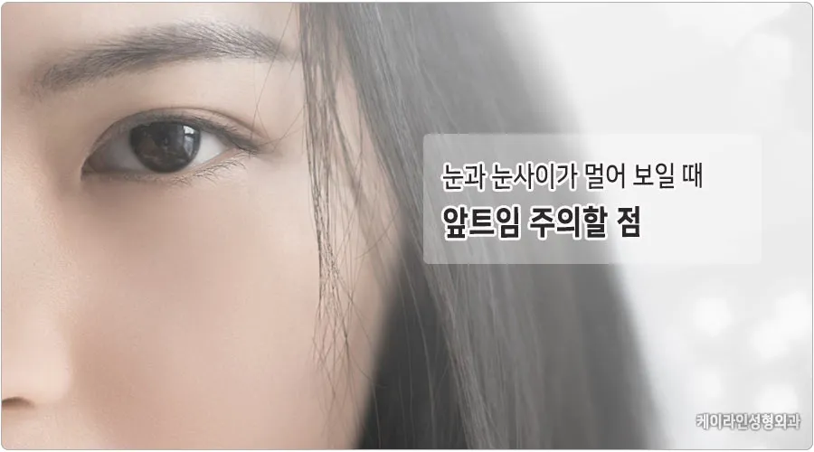 눈과 눈사이 점 관상 의미와 해석_2