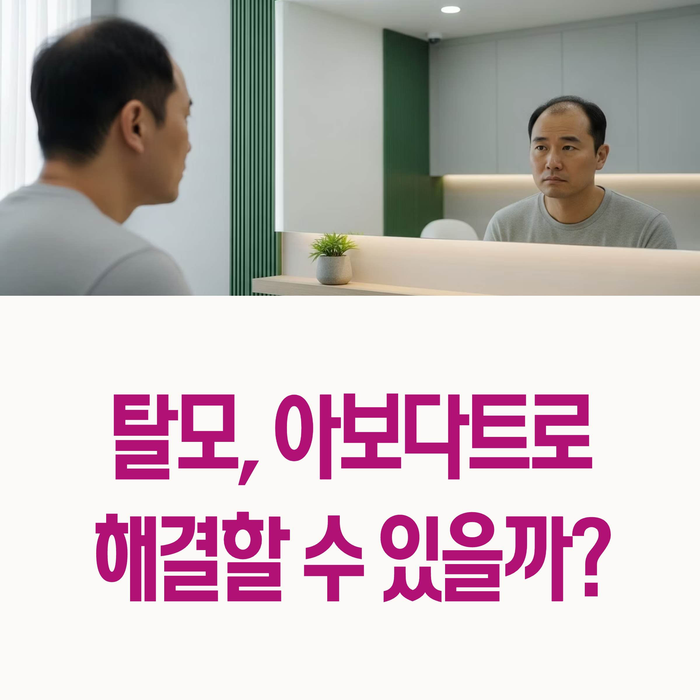두타스테리드 탈모약 정보, dutasteride hair loss treatment guide