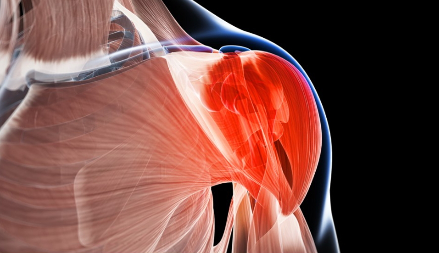 콘드로이친 1200mg