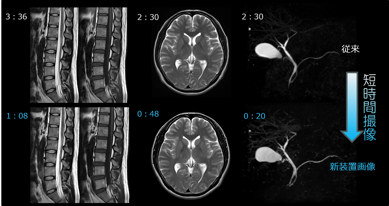 뇌 MRI 검사 비용