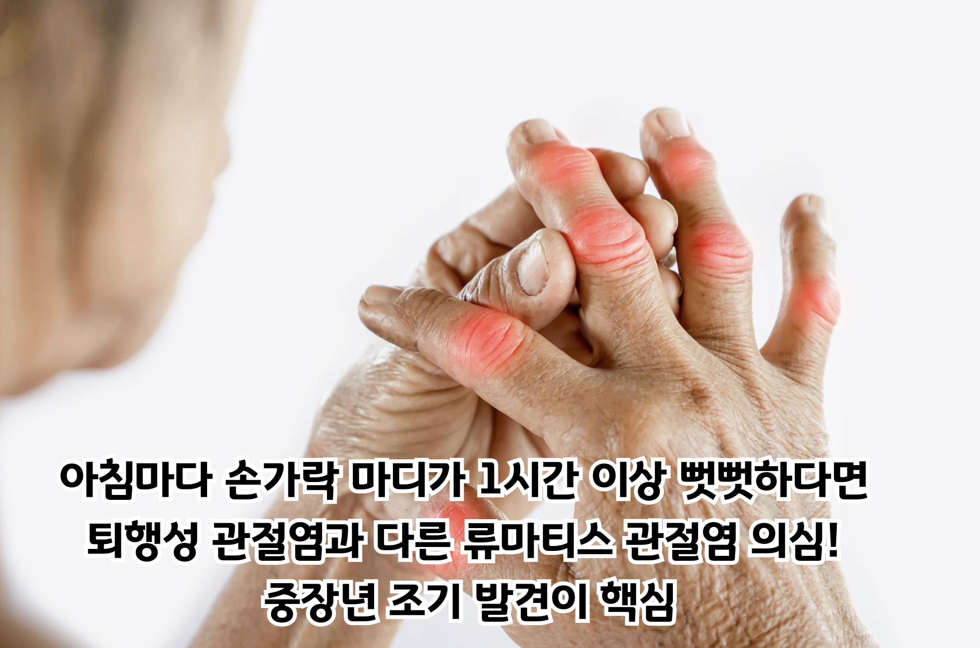 중장년 류마티스 관절염 진단과 치료: 조기 발견의 중요성과 최신 치료법