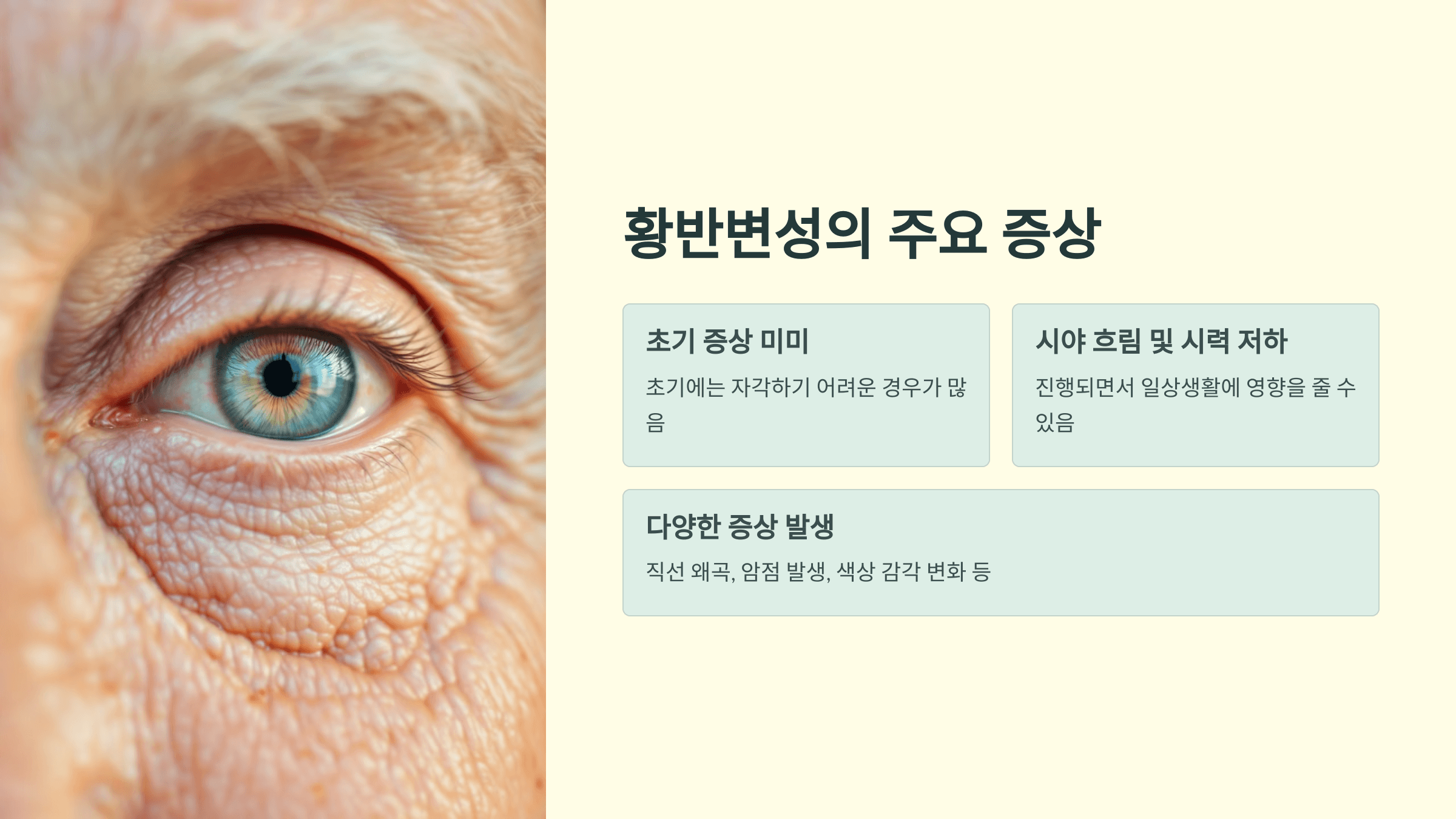 황반변성과 관련된 사진입니다.