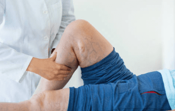 하지 정맥류 증상 수술비용