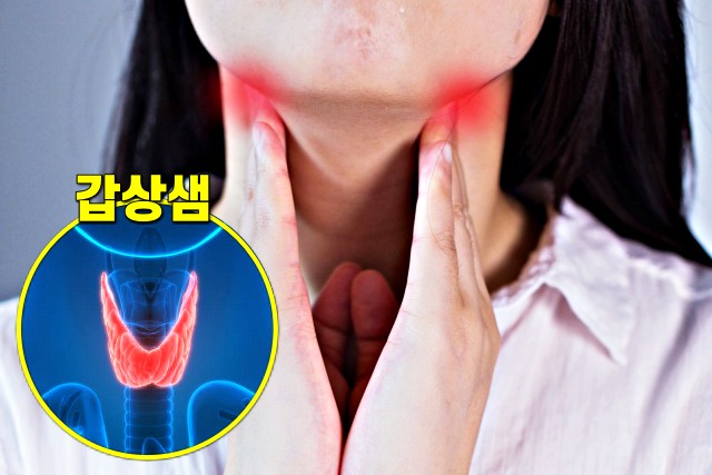 피곤하고 졸린 증상 6가지, 갑상샘 기능 저하증