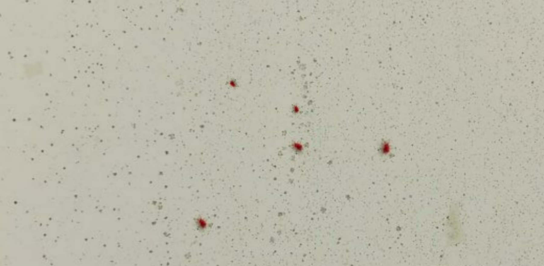 빨간진드기(다카라다니)