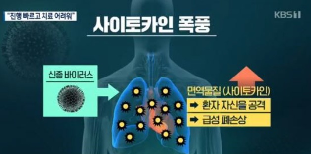 사이토카인 폭풍