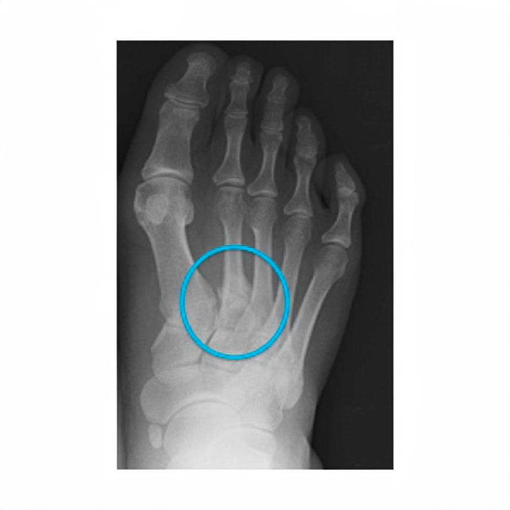 뉴진스 혜인 활동 중단