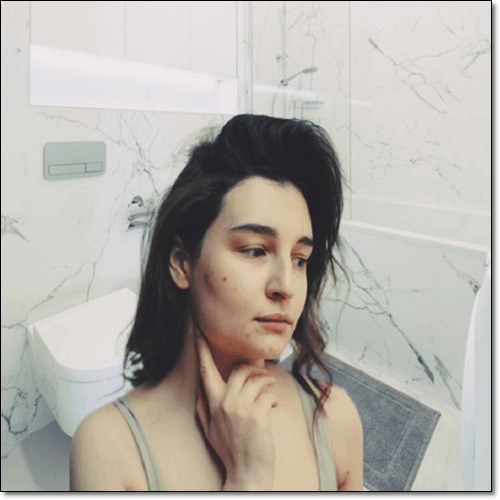 염증이 생긴 여성