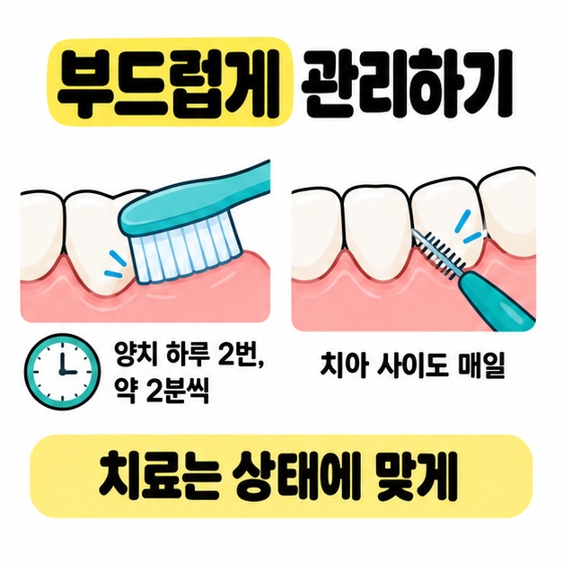 부드러운 칫솔질과 치간칫솔 사용 장면 옆에 하루 두 번 약 2분씩 양치하고 치아 사이도 매일 관리하라는 문구를 배치한 모습