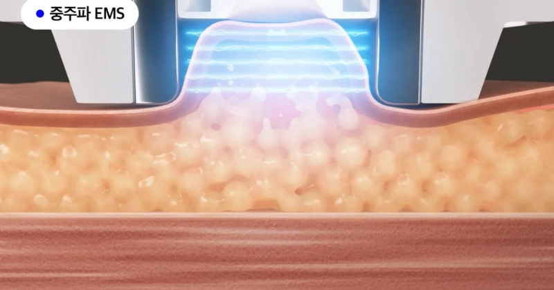 메디큐브 에이지알 바디샷