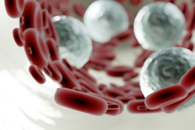 경동맥 협착증 증상