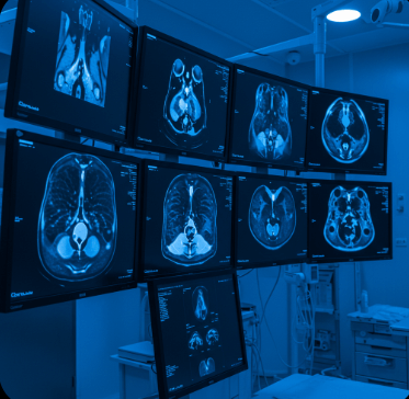 비인두암 초기증상 및 원인15