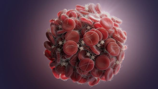 혈소판 수치 올리는 방법