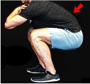 벗윙크