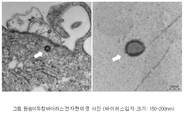 원숭이두창 바이러스 분리 성공&middot;유전정보 공개