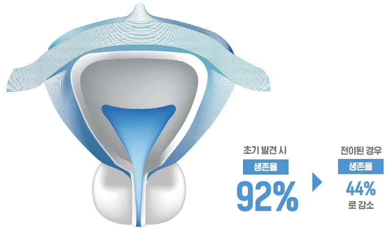전립선암 초기증상