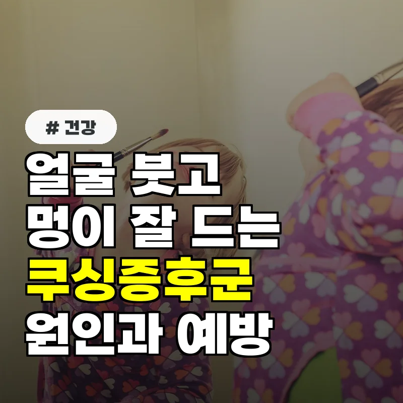 얼굴 붓고 멍이 잘 드는 40대 이상, 쿠싱증후군 원인 3가지와 예방법