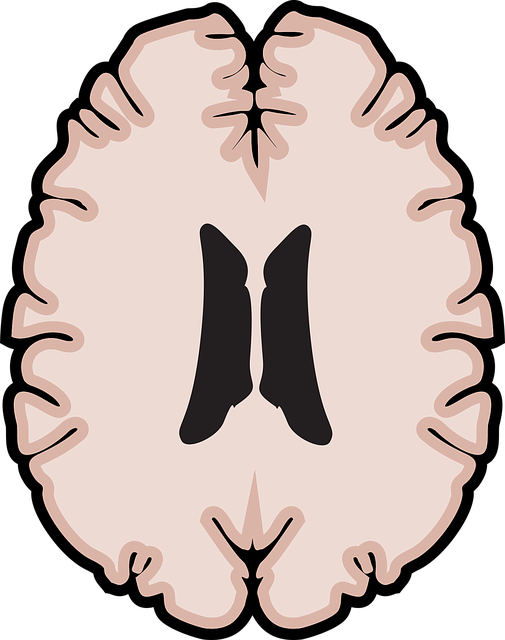 뇌 영양제 추천 TOP5 치매 예방