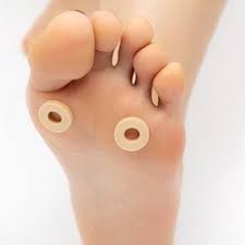 티눈이 생기는 이유