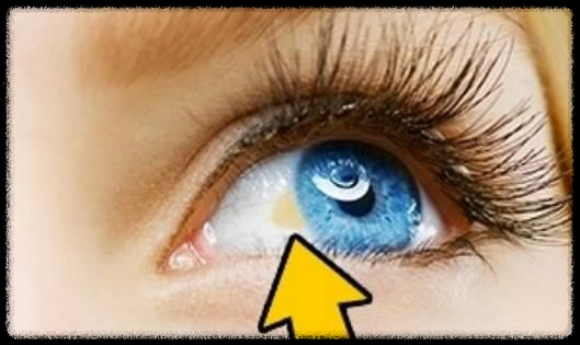 눈으로 보는 건강 신호: 갑상선저하증부터 폐암까지 안질환 증상 파헤치기