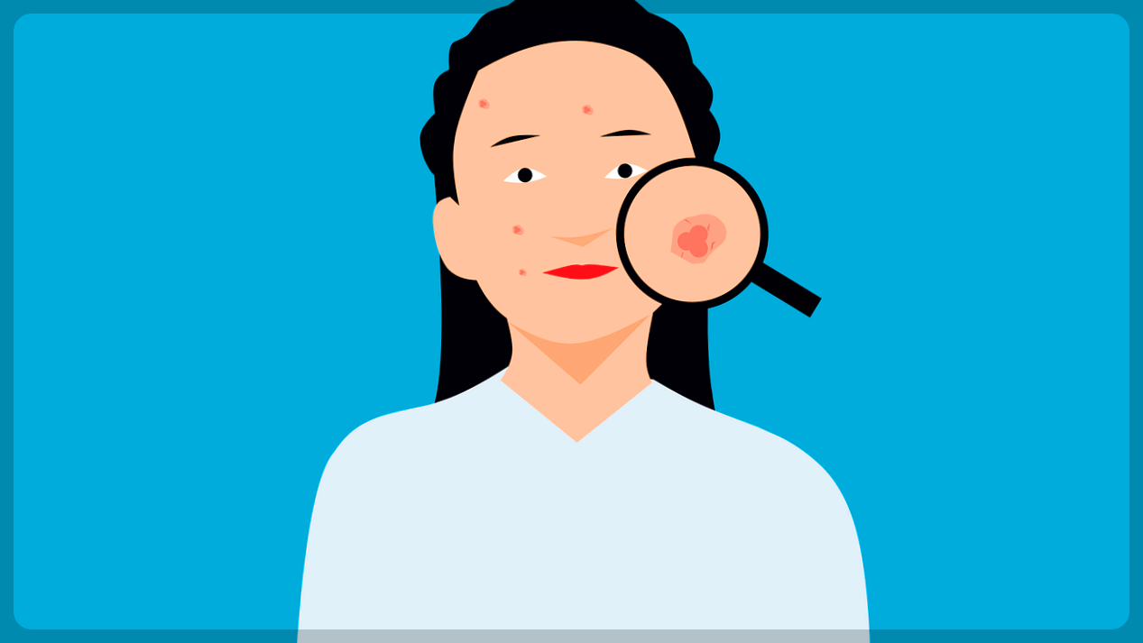 여성 피부트러블