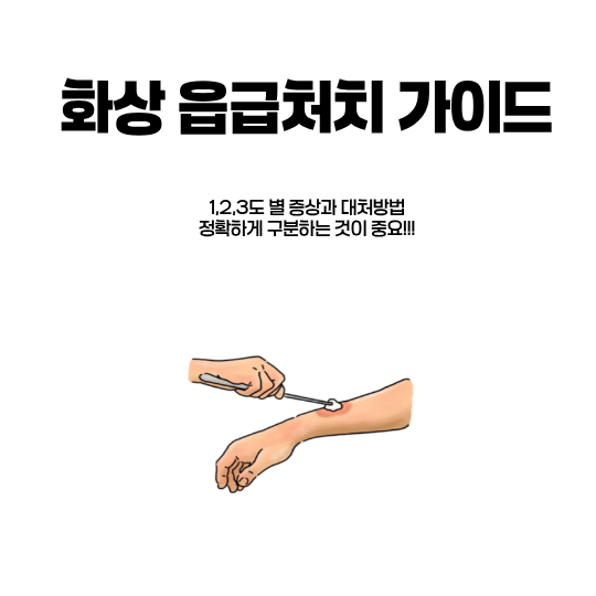 화상-응급처치