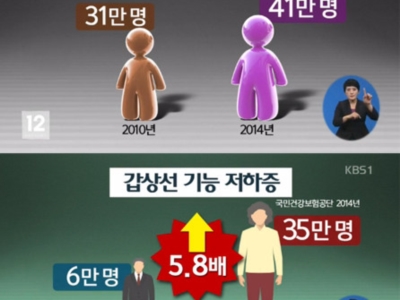 갑상선 이미지