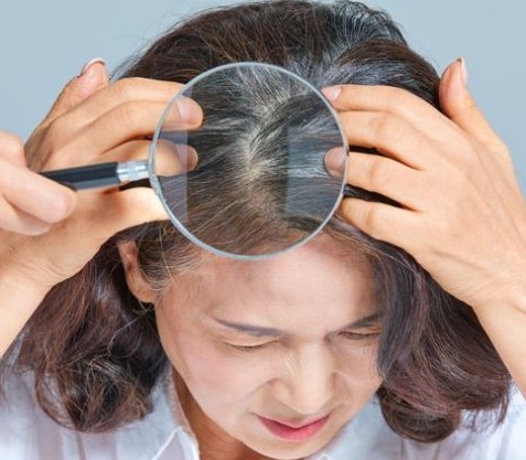 "내 정수리만 휑한가?" 싶을 때, 봐야 할 탈모 솔루션