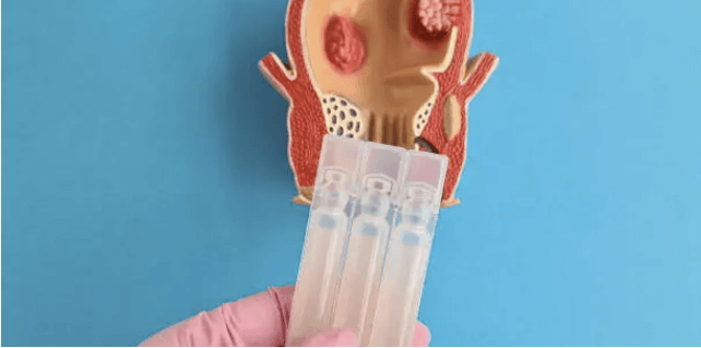 치질의 증상과 치질 자가치료법, 치질 예방법 요약정리