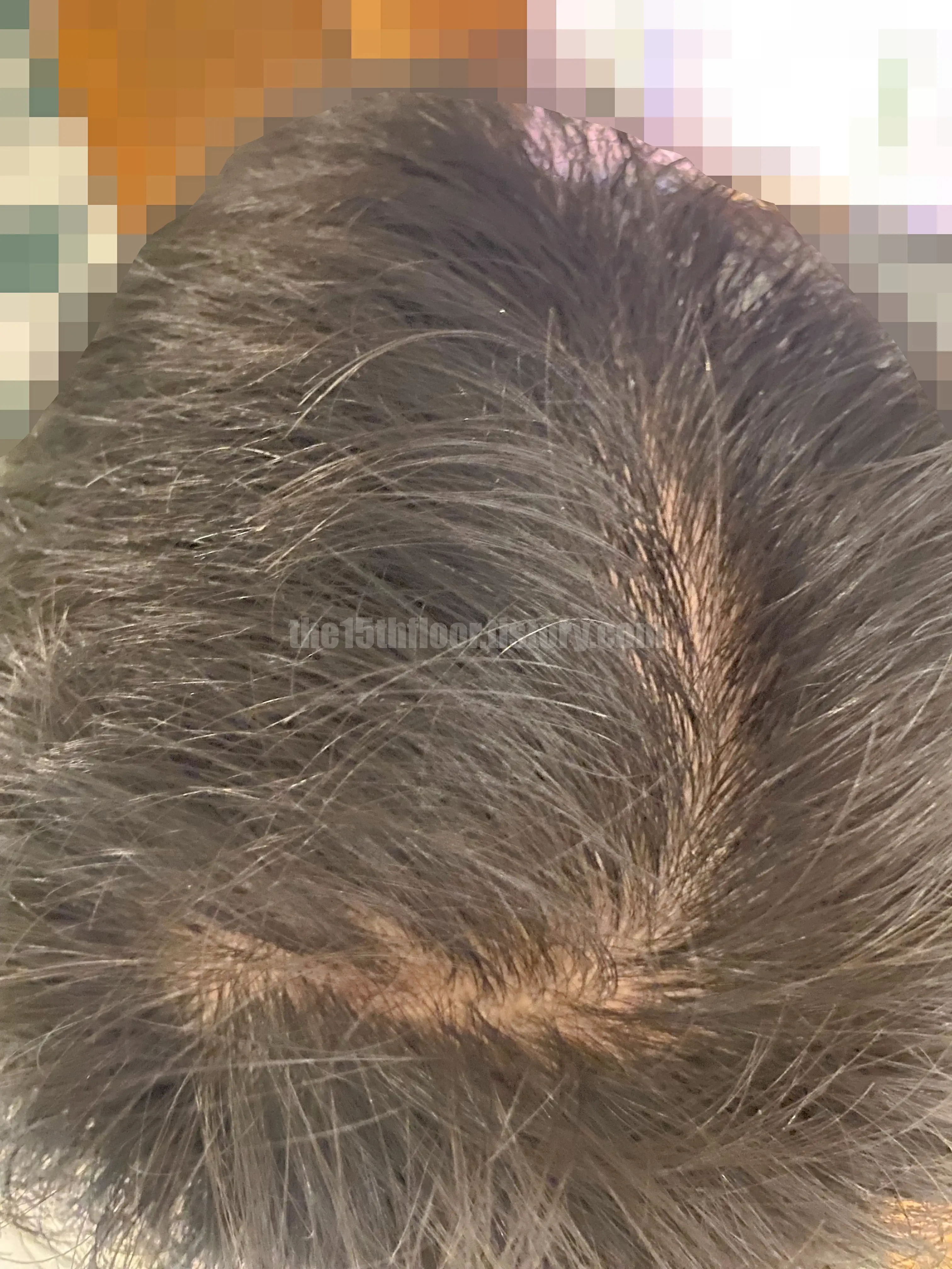 로게인폼 3개월 사용 후기 (사용 전)