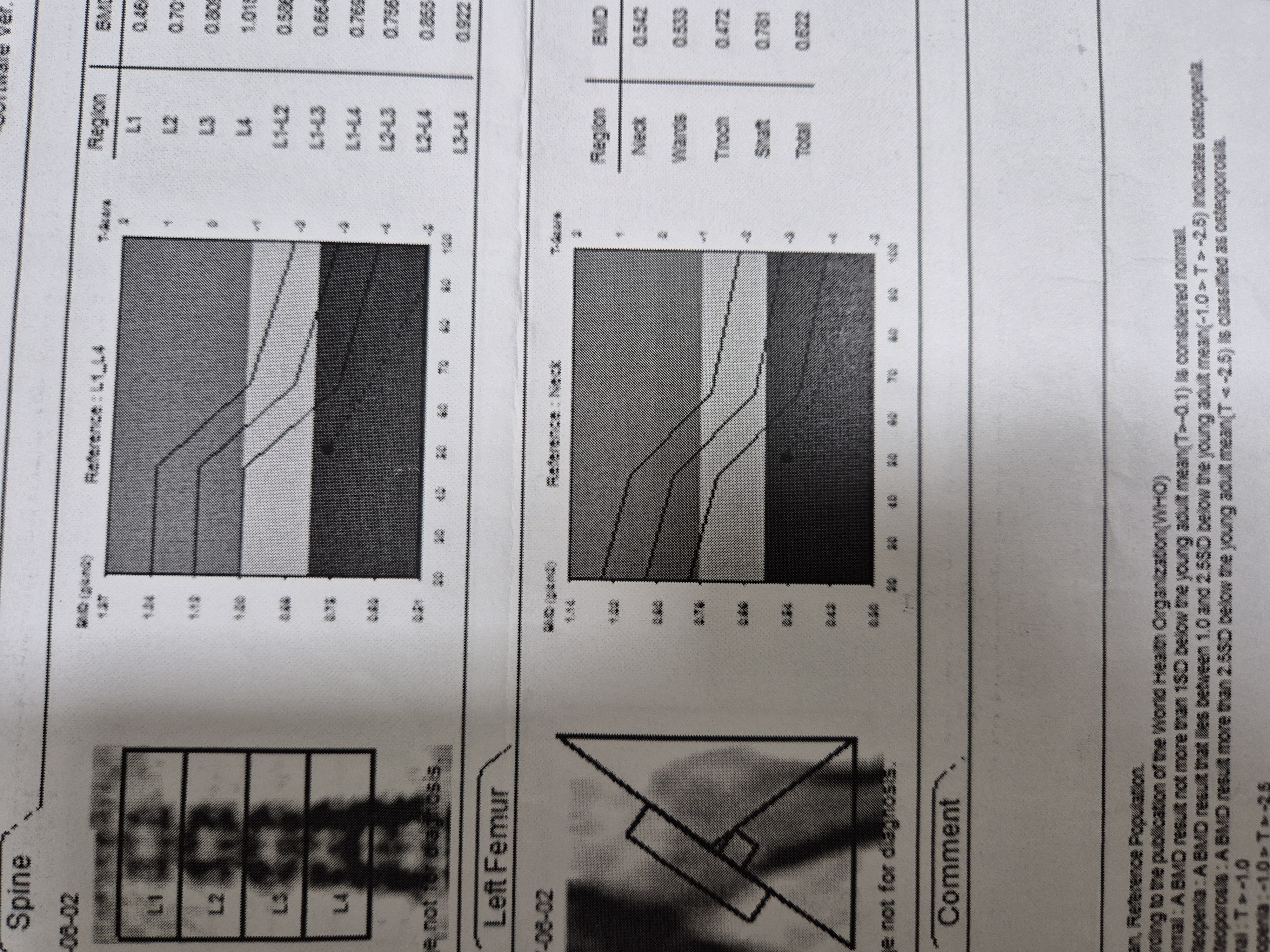 골밀도 검사결과 표