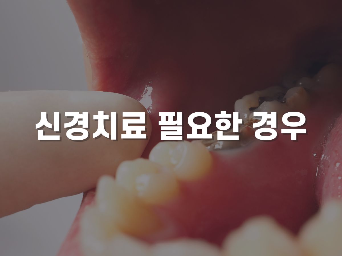 신경치료가 필요한 경우