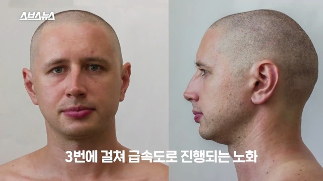 30대 후반 여성 급노화, 얼굴 주름살, 피부관리, 자기관리, 건강 뷰티 팁줌 매일꿀정보