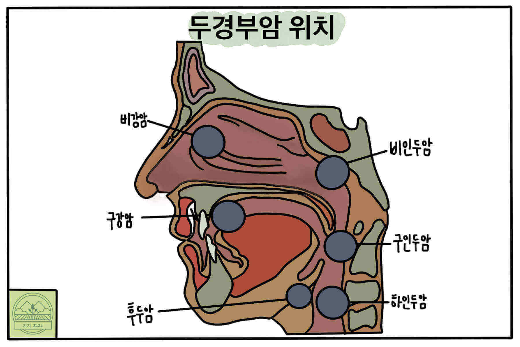 두경부암 위치