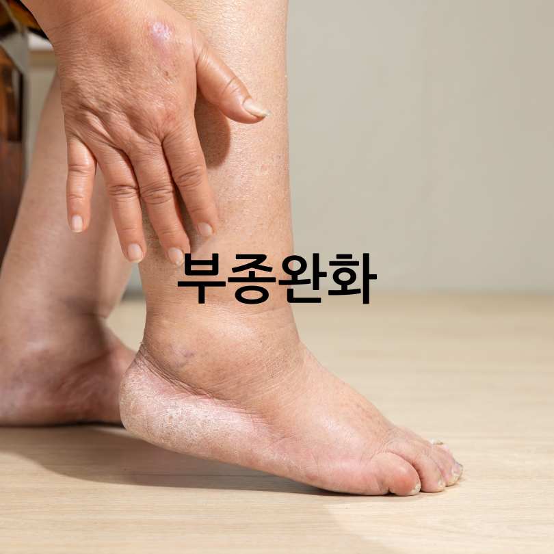 지압 슬리퍼 부작용과 효과 