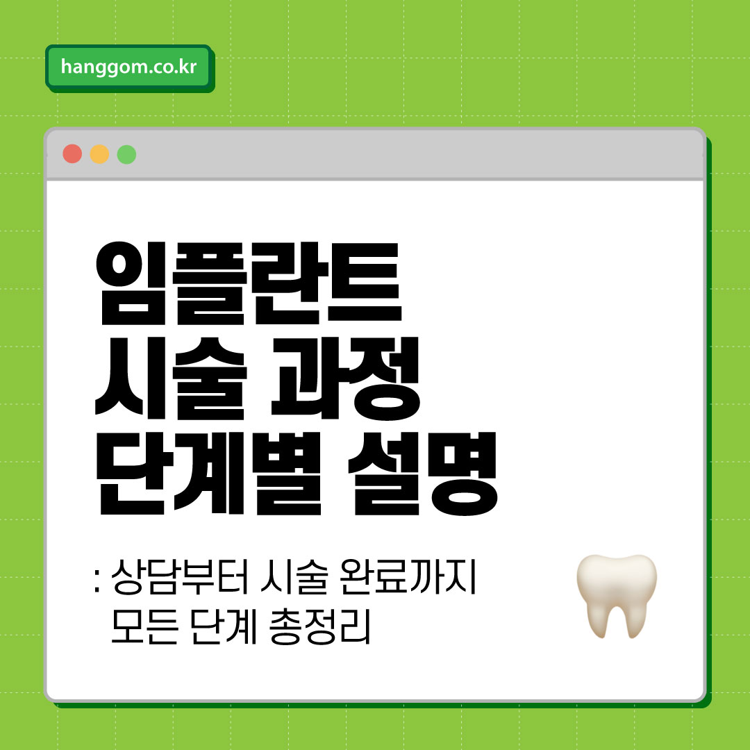 임플란트 시술 과정 단계별 설명: 상담부터 시술 완료까지 모든 단계 총정리