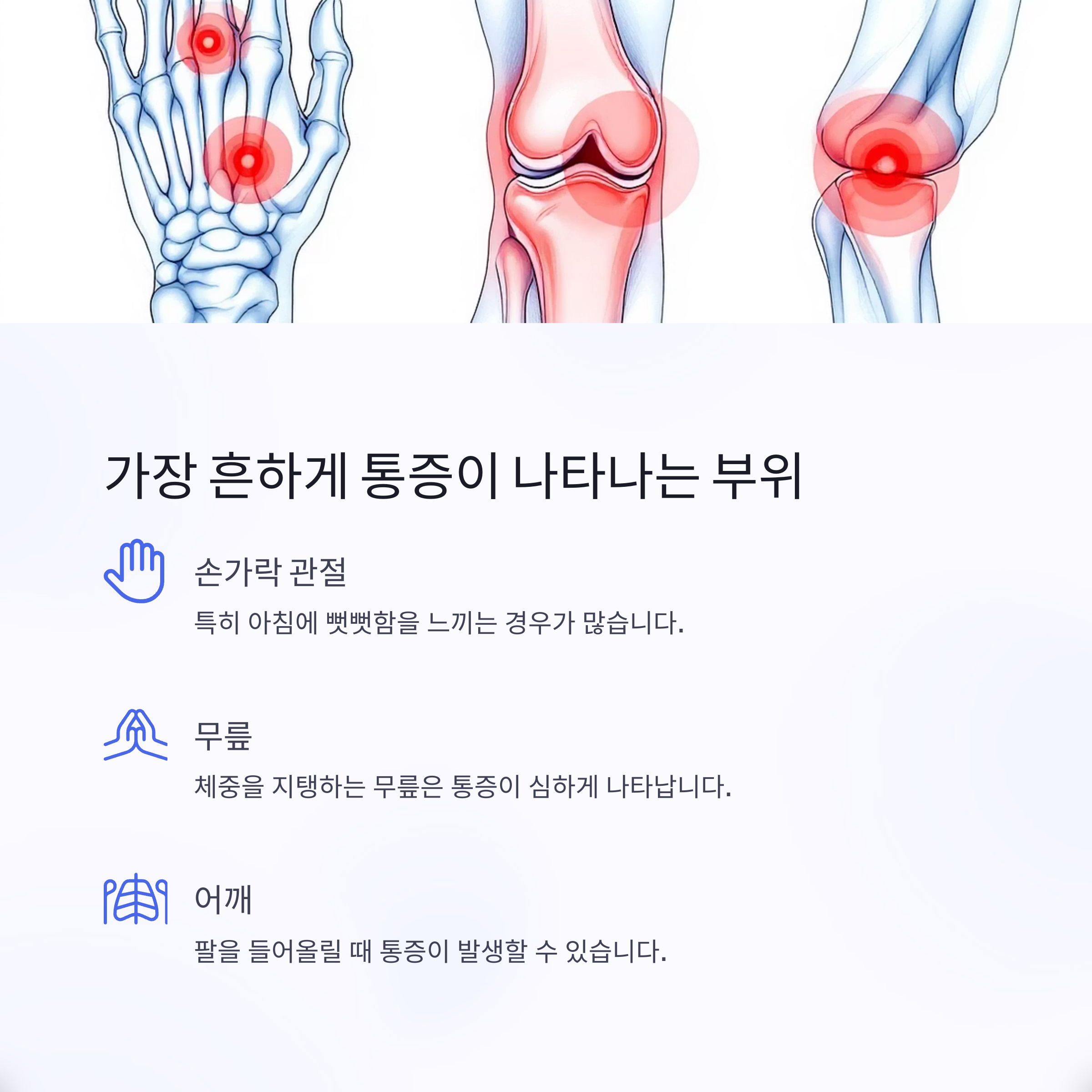 갱년기 관절 통증, 원인부터 치료·음식까지 총정리