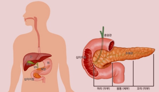췌장 위치 및 구조를 나타낸 그림입니다.