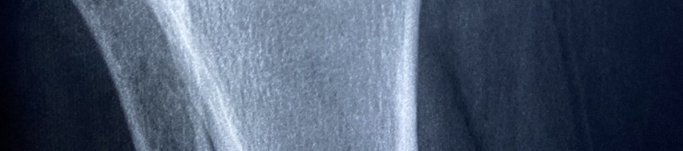 콘드로이친 효능 이미지