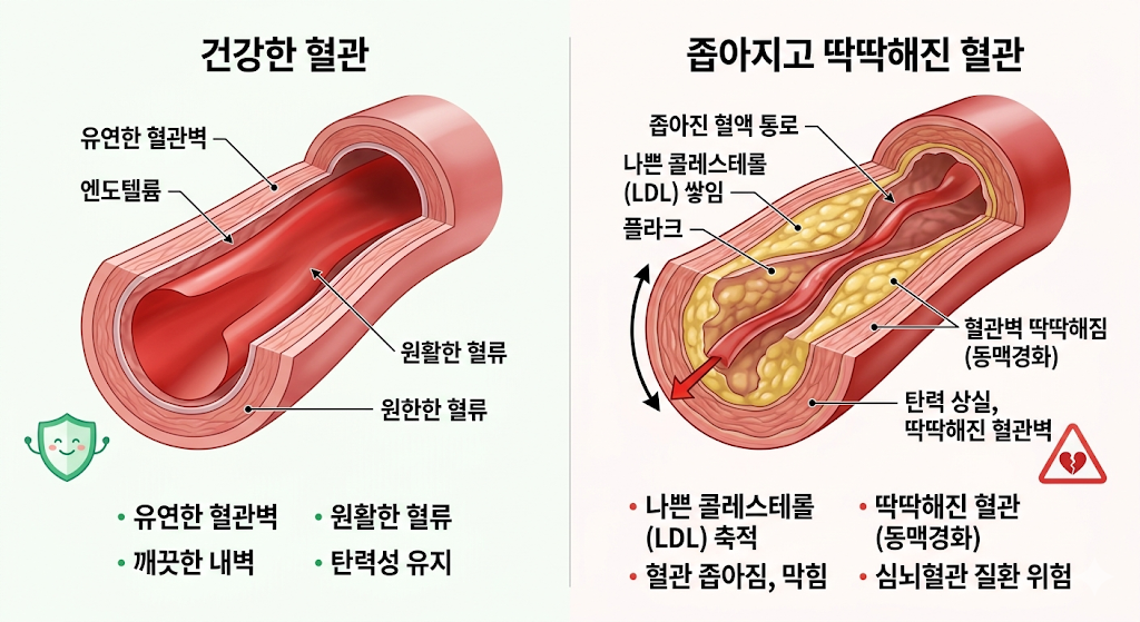 건강한 혈관, 좁아지고 딱딱한 혈관
